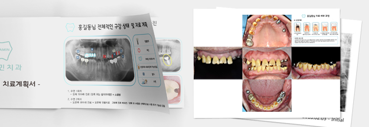 투명치료 치료과정